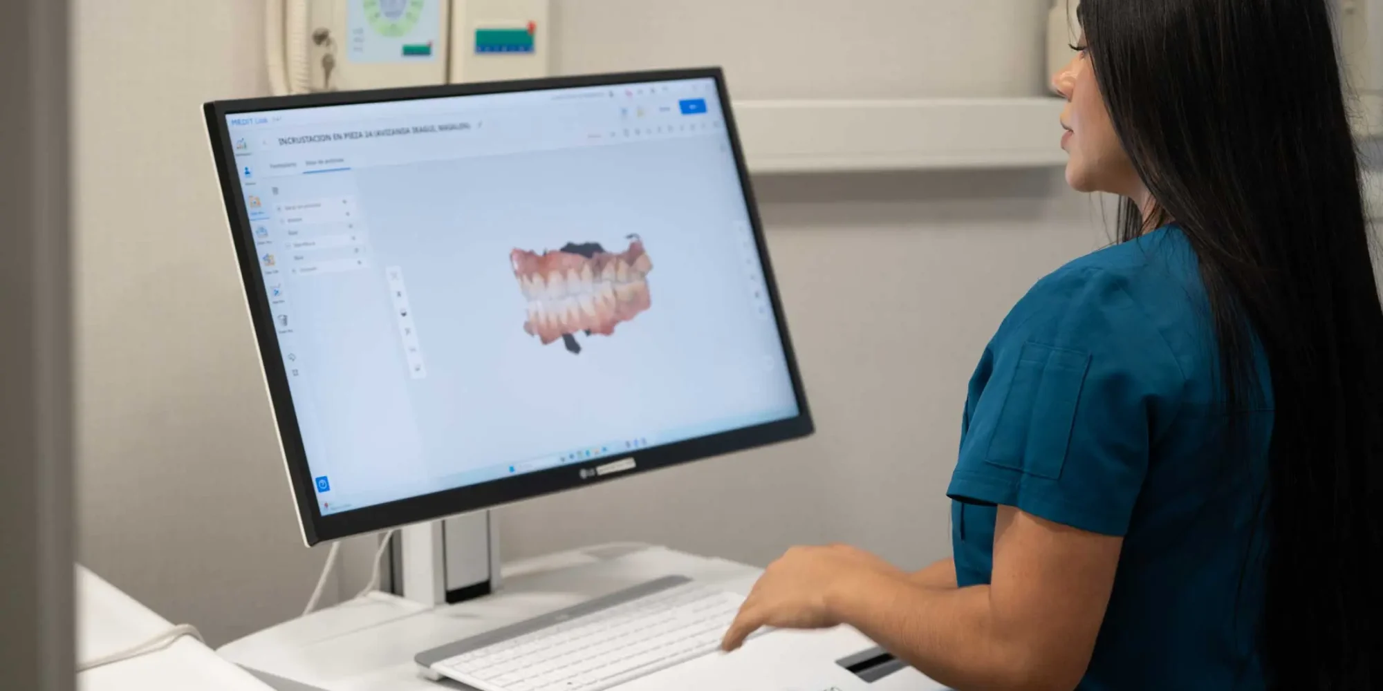 Moderno escáner en la Clínica Dental Mendía